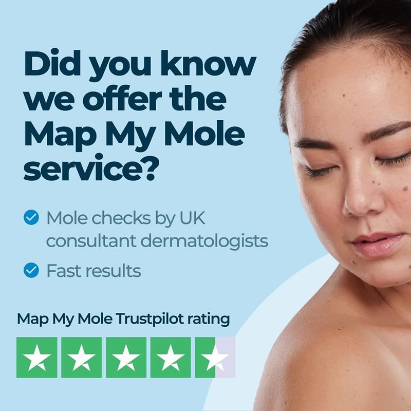 We offer a Map My Mole service